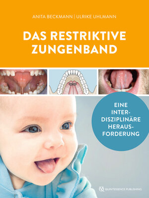 cover image of Das restriktive Zungenband